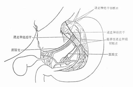 金華清宮手術那里好